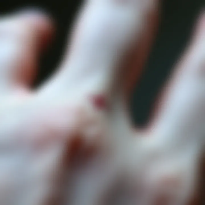 A close-up of a hand showing a freckle between the middle and index fingers, highlighting the unusual mark.