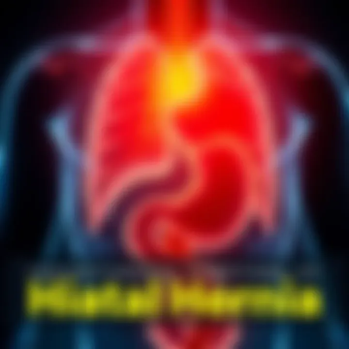 Illustration showing various symptoms of hiatal hernia like chest pain, heartburn, and difficulty swallowing, with a focus on the stomach area